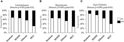 Cardiometabolic risk factors in MASLD patients with HCC: the other side of the coin